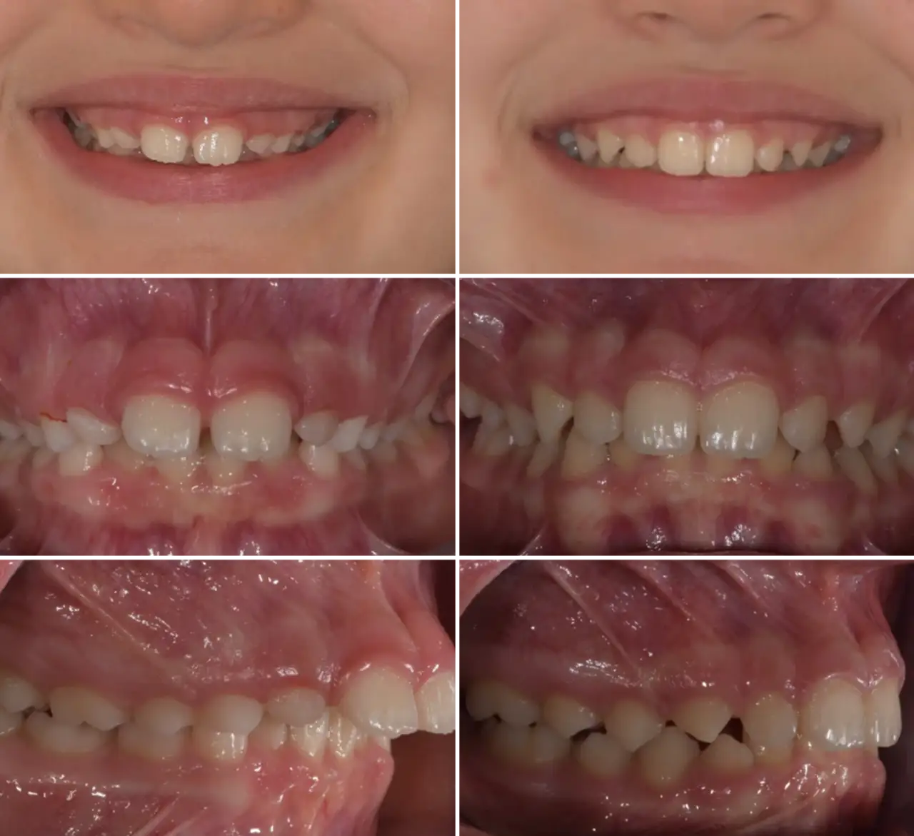 Casi Clinici - Ortodontica Italia